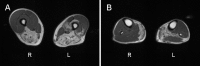 Figure 2. A.