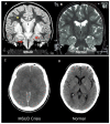 Figure 2. A.