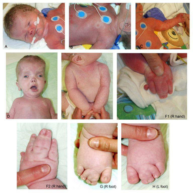 Figure 2. . Features of MCAP syndrome.