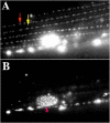 Figure 6. Localization of UNC-97::GFP within muscle body wall muscle.