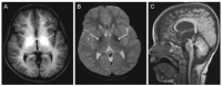 Figure 1. A.