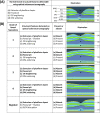 Figure 1. . (A) Illustration of the unique features of a normal fovea detectable on optical coherence tomography.