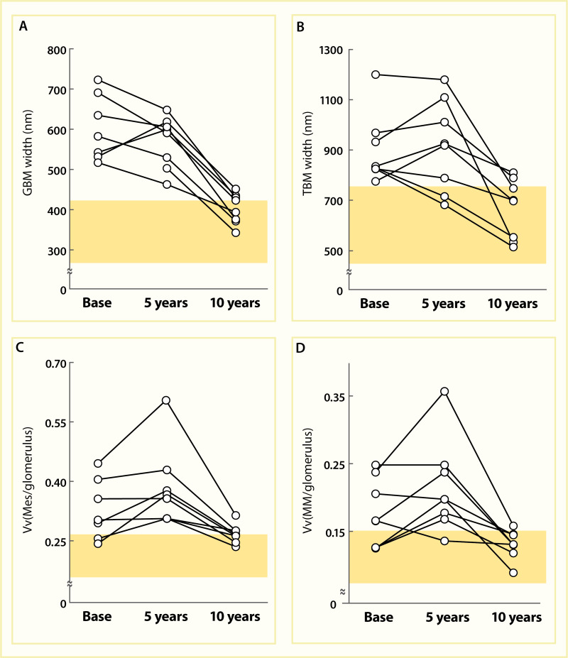 Line graphs showing decreases in G B M thickness, T B M thickness,
mesangial fractional volume, and mesangial matrix fractional volume 10 years
after pancreas transplantation